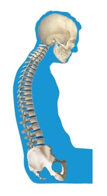 abnormal_curvature_of_the_spine_kyphosis.jpg