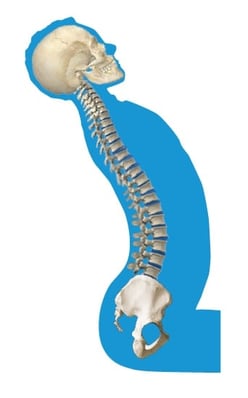 abnormal_curvature_of_the_spine_lumbar_lordosis.jpg